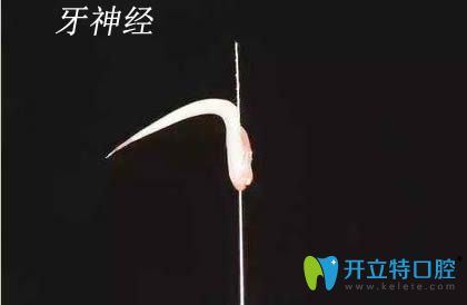 牙齒神經(jīng)圖片