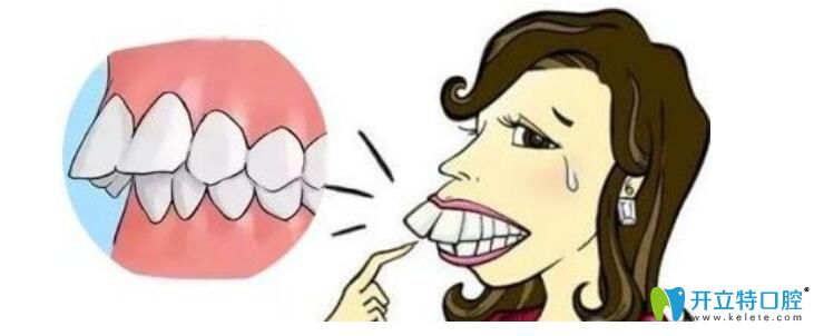 正頜手術(shù)是什么