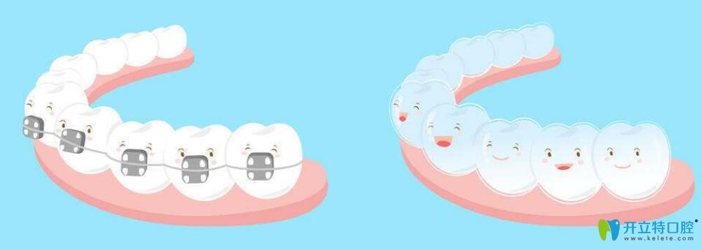 正頜和正畸手術(shù)的區(qū)別？正頜手術(shù)哪里做得好,費(fèi)用是多少？