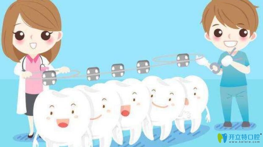 矯牙為什么那么貴？資深牙醫(yī)告訴你不知道的正牙價(jià)格內(nèi)幕