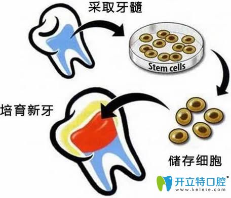 牙髓再生技術(shù)