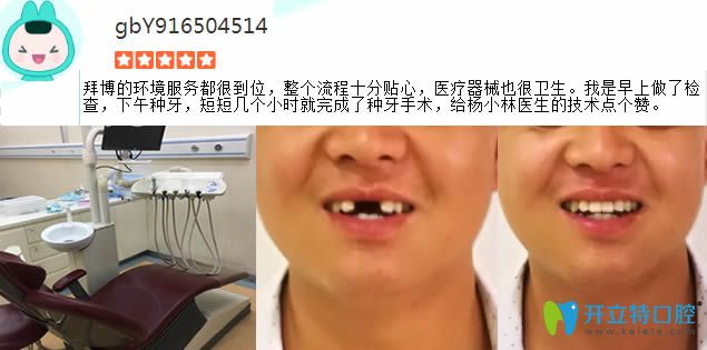 門牙缺失在拜博做完種植牙對比圖 門牙缺失在拜博做完種植牙對比圖