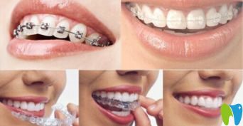 談牙齒矯正一般多久復(fù)診一次及重要性