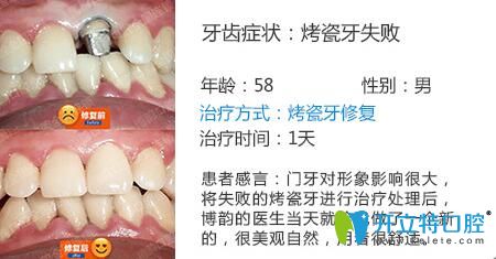醫(yī)生姓名：周光正   醫(yī)生資質(zhì)：全科醫(yī)生  所屬機(jī)構(gòu)：南京博韻口腔  社會(huì)任職：  畢業(yè)院校：畢業(yè)于邢臺(tái)<!--<i data=20240703-sp></i>-->口腔醫(yī)學(xué)系  主診項(xiàng)目：牙列缺損修復(fù)、口腔種植、前牙美學(xué)修復(fù)、嵌體修復(fù)及復(fù)雜牙拔除。