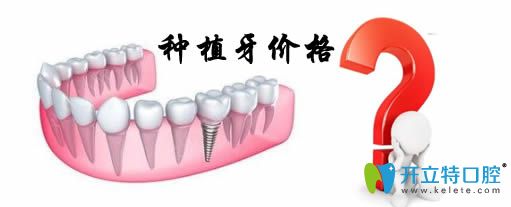 通過(guò)重慶種植牙價(jià)格表來(lái)揭秘重慶種植牙多少錢一顆？