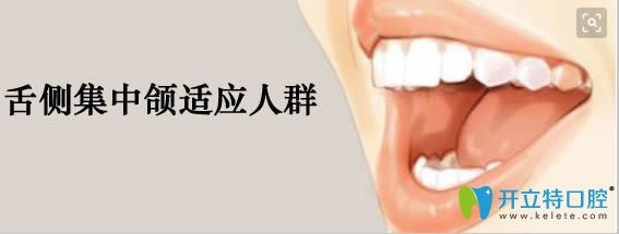 舌側集中頜全口排列適應人群：