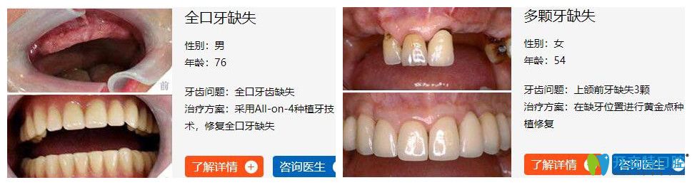 海濤口腔種植牙怎么樣？<span style=