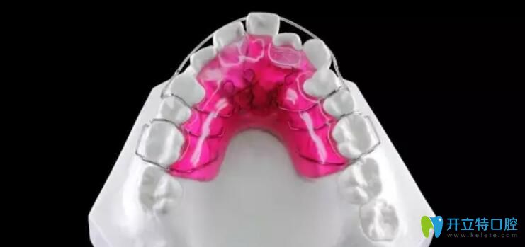活動(dòng)矯正器優(yōu)缺點(diǎn)