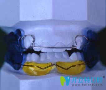 法蘭克爾矯正器