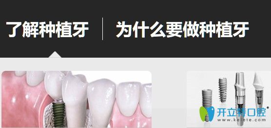 種植牙多少錢(qián)一顆