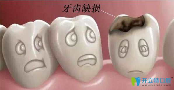 牙齒缺損修復方法哪種比較好?樂山英美口腔給出答案