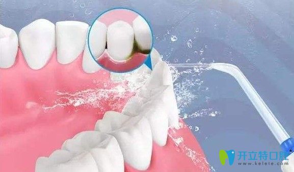 治療牙周病要多少錢