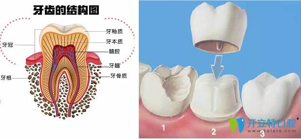 等待修復體的時間段戴臨時冠的作用很重要