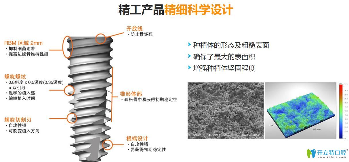 韓國種植牙質量怎么樣？韓國種植體價格為什么比較便宜？