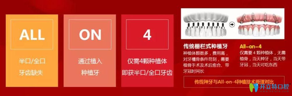 北極星口腔All-on-4即刻負重種植技術