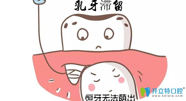 融合牙換牙后會好嗎