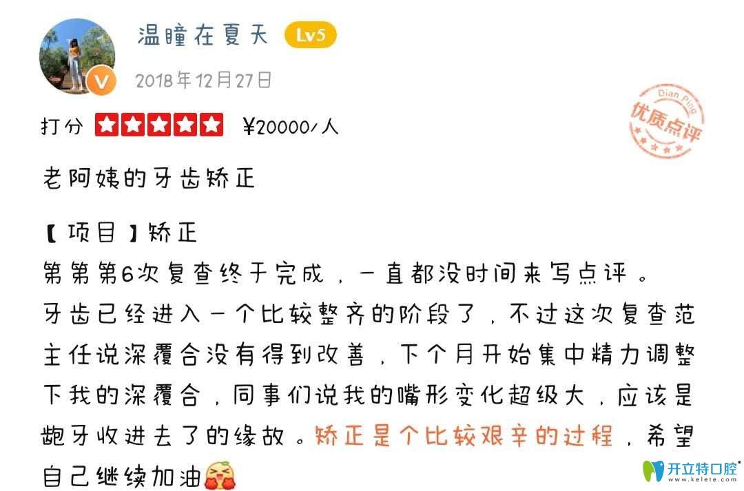 顧客正在成都圣貝口腔正畸中，表示變化挺大的