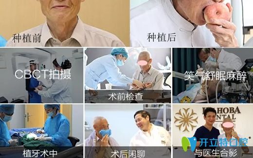 東莞好佰年口腔的數(shù)字化種植牙步驟和效果