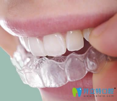 韋飛科普隱形牙齒矯正有哪些優(yōu)點