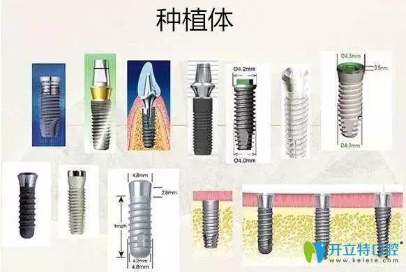 種植牙價(jià)格貴和便宜的區(qū)別在哪