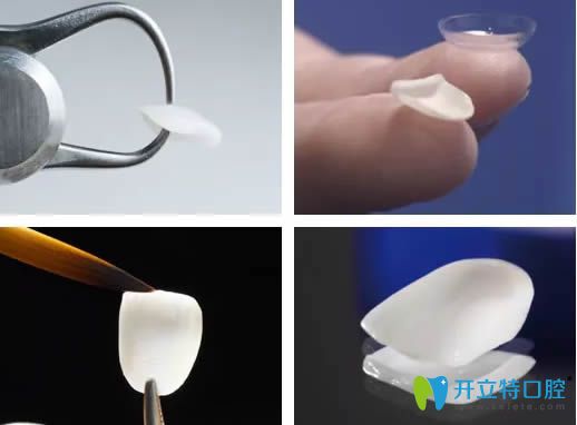 牙齒超薄全瓷貼面材料圖