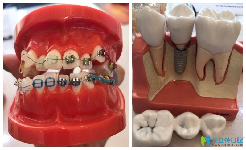 中山好民生口腔特色技術