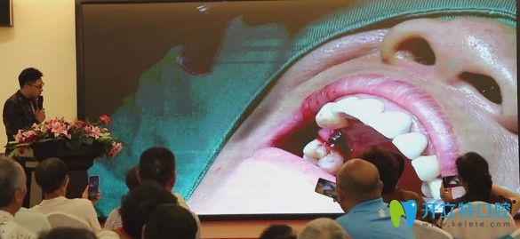 天津中諾口腔趙振宇院長案例分享