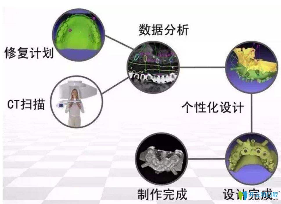 南昌輝煌口腔丁張松醫(yī)生介紹數(shù)字化種植牙技術(shù)優(yōu)勢