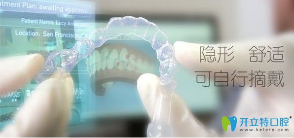 廣州曙光口腔隱適美隱形矯治優(yōu)勢(shì)