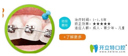 長沙利爾口腔金屬自鎖托槽矯正需要的時(shí)間