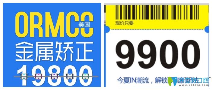 成都圣貝口腔美國奧美科金屬矯正價(jià)格