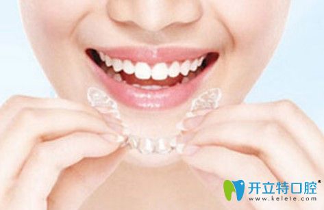 格倫菲爾口腔隱形矯正器