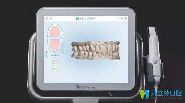 諾德齒科網紅黑科技口掃