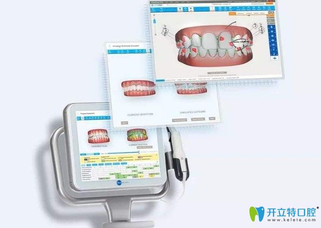 諾德口腔口掃儀