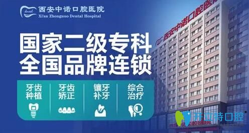 西安種植牙哪家醫(yī)院好？中諾口腔立得用種植牙可靠效果好