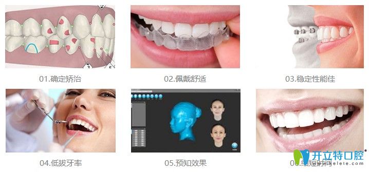 北京維嘉口腔數(shù)字化正畸優(yōu)勢 北京維嘉口腔數(shù)字化正畸優(yōu)勢