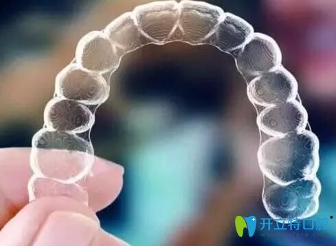 我在深圳弘和口腔戴的隱適美隱形牙套 我在深圳弘和口腔戴的隱適美隱形牙套