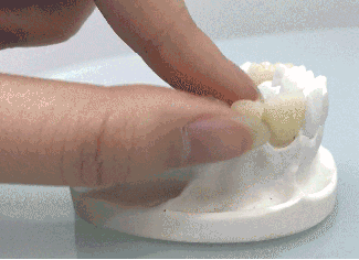 做烤瓷牙疼嗎？網(wǎng)呼千萬不要做烤瓷牙是因為磨牙疼嗎？