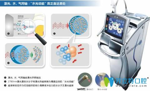 水激光口腔治療儀器