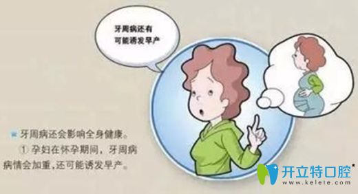 做好孕期口腔保健可預(yù)防齲齒