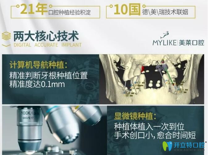 深圳美萊口腔3D顯微精準(zhǔn)種植技術(shù)
