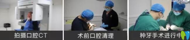 高齡老人種牙前檢查