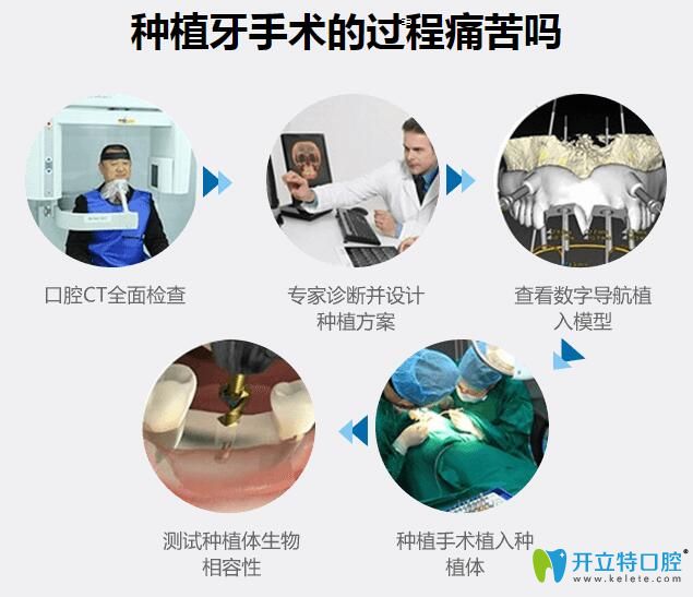 北京瑞鯊口腔吳志強(qiáng)醫(yī)生告訴你種植牙手術(shù)疼嗎