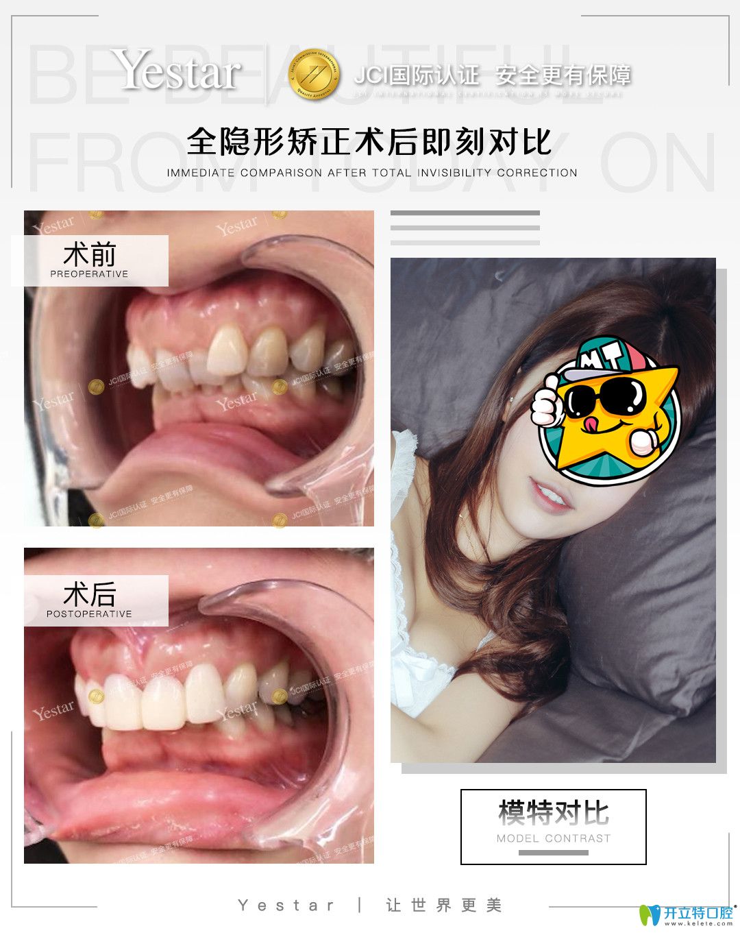 在寧波藝星口腔戴隱形牙套是什么感受，真實(shí)正畸經(jīng)驗(yàn)分享