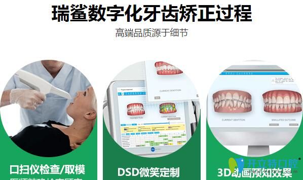 北京瑞鯊口腔數(shù)字化牙齒矯正過程