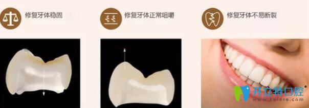 威蘭德全瓷牙的優(yōu)缺點(diǎn)