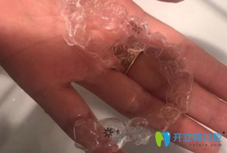 隱適美隱形牙套效果圖 隱適美隱形牙套效果圖