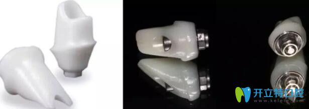 種植牙全瓷基臺(tái)