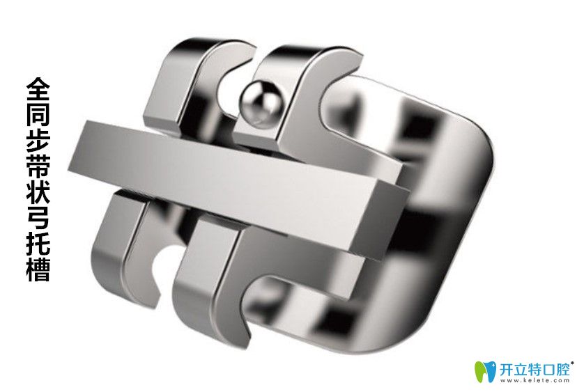 全同步帶狀弓矯治器的優(yōu)缺點