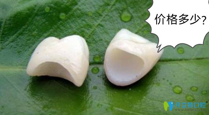 仿生冠牙齒多少錢呢